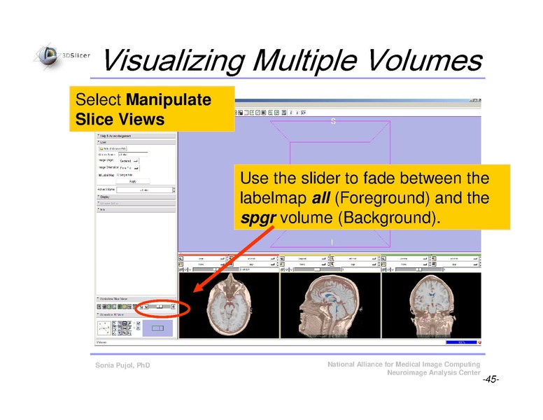File:Slicer3Course DataLoading 3DVisualization SoniaPujol.pdf