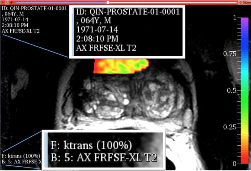File:Redview slice view annotations.png
