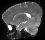 this is associated B0 image. Aligned with FA. Will use this as registration reference (fixed image)