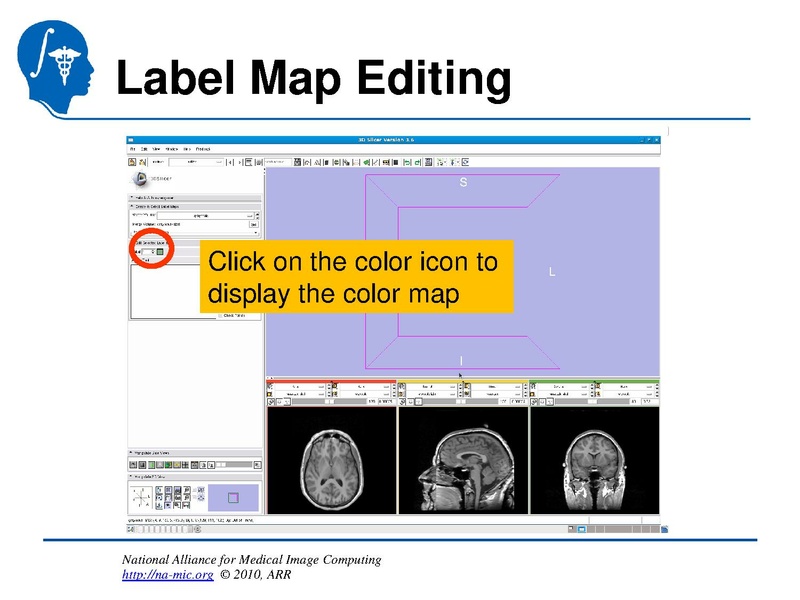 File:InteractiveEditorTutorial Slicer3.6-SoniaPujol.pdf