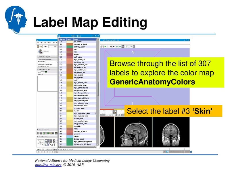 File:InteractiveEditorTutorial Slicer3.6-SoniaPujol.pdf