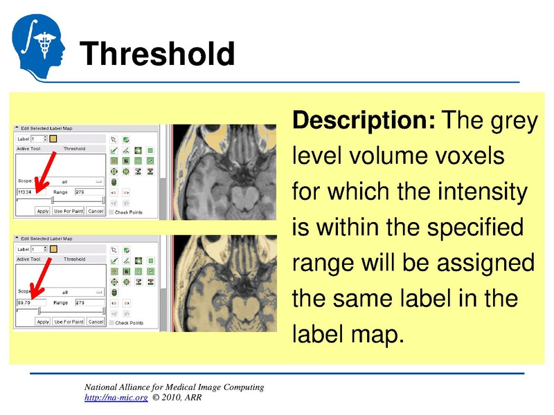File:InteractiveEditorTutorial Slicer3.6-SoniaPujol.pdf