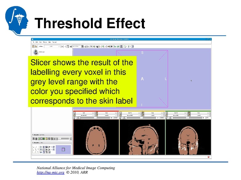 File:InteractiveEditorTutorial Slicer3.6-SoniaPujol.pdf