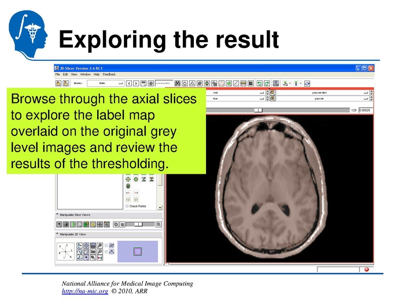 File:InteractiveEditorTutorial Slicer3.6-SoniaPujol.pdf