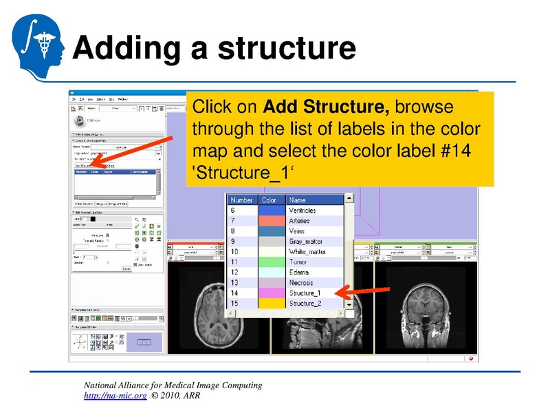 File:InteractiveEditorTutorial Slicer3.6-SoniaPujol.pdf