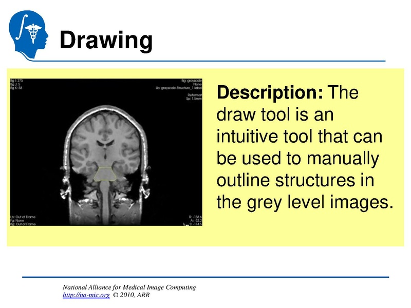 File:InteractiveEditorTutorial Slicer3.6-SoniaPujol.pdf