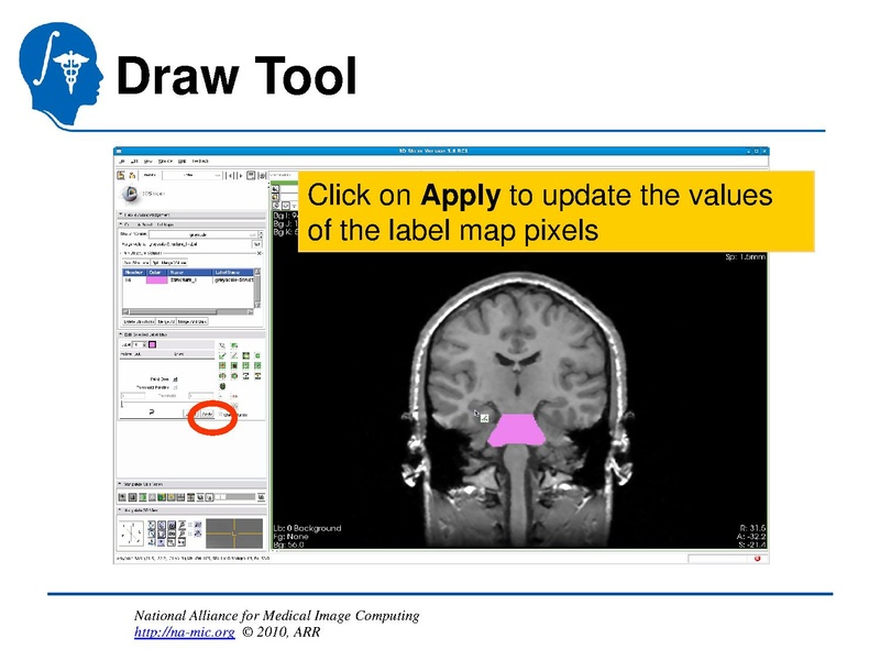 File:InteractiveEditorTutorial Slicer3.6-SoniaPujol.pdf