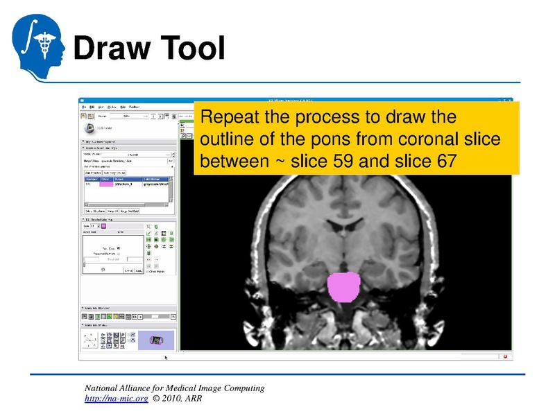 File:InteractiveEditorTutorial Slicer3.6-SoniaPujol.pdf