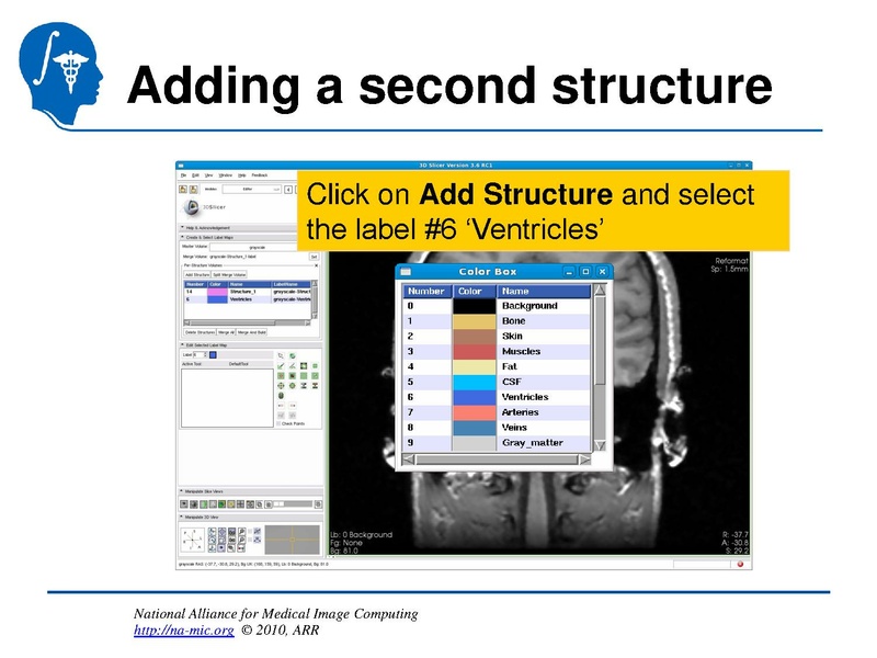 File:InteractiveEditorTutorial Slicer3.6-SoniaPujol.pdf
