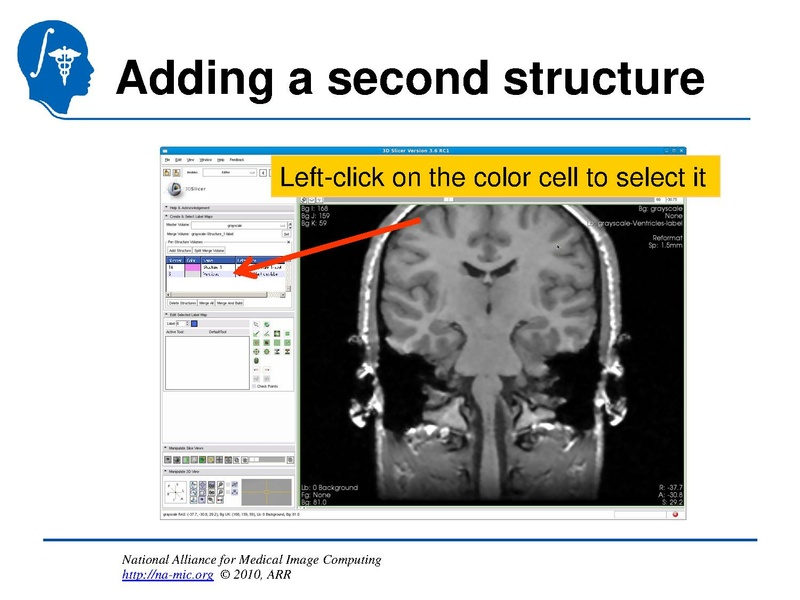 File:InteractiveEditorTutorial Slicer3.6-SoniaPujol.pdf