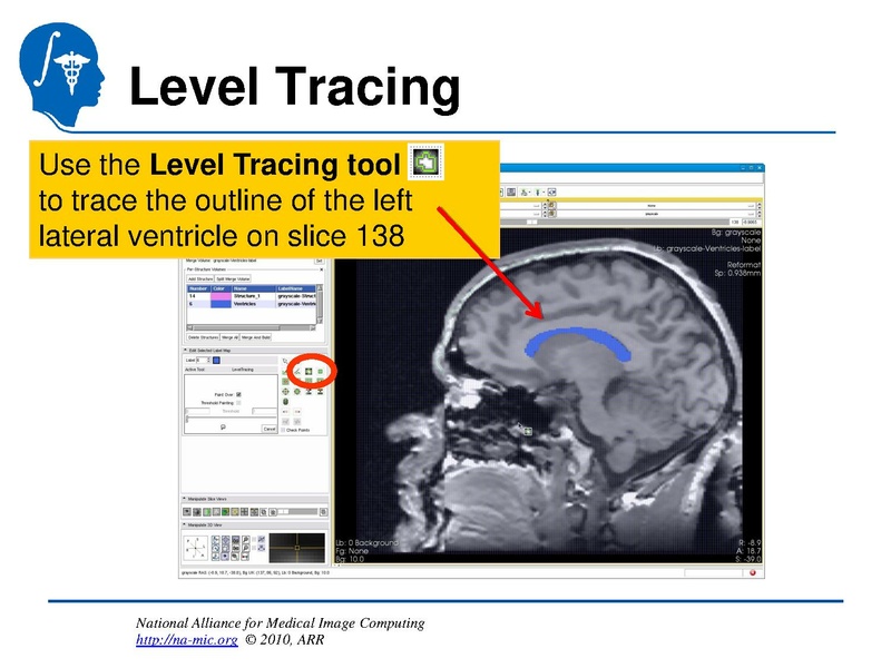 File:InteractiveEditorTutorial Slicer3.6-SoniaPujol.pdf