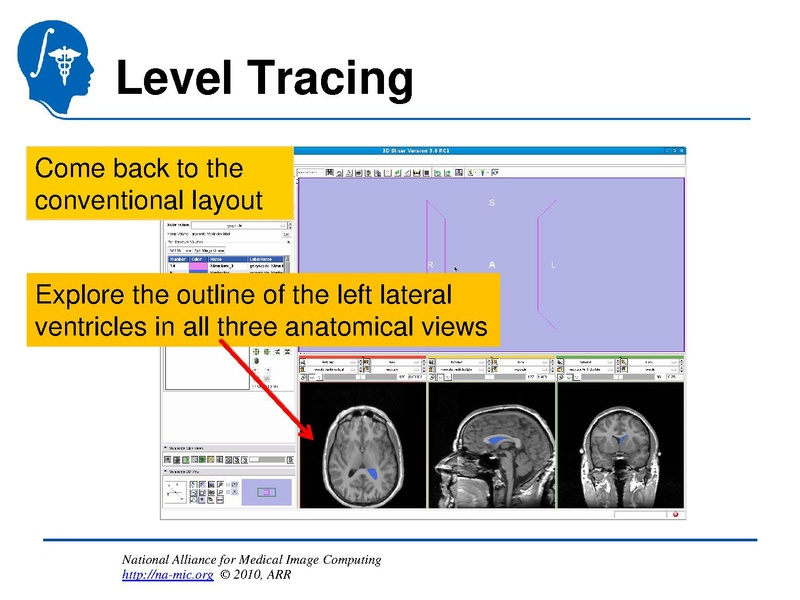 File:InteractiveEditorTutorial Slicer3.6-SoniaPujol.pdf