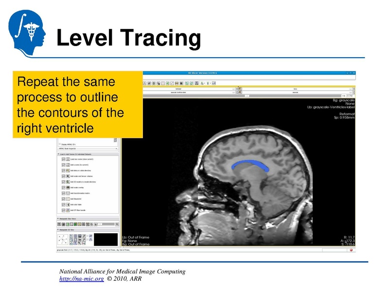 File:InteractiveEditorTutorial Slicer3.6-SoniaPujol.pdf