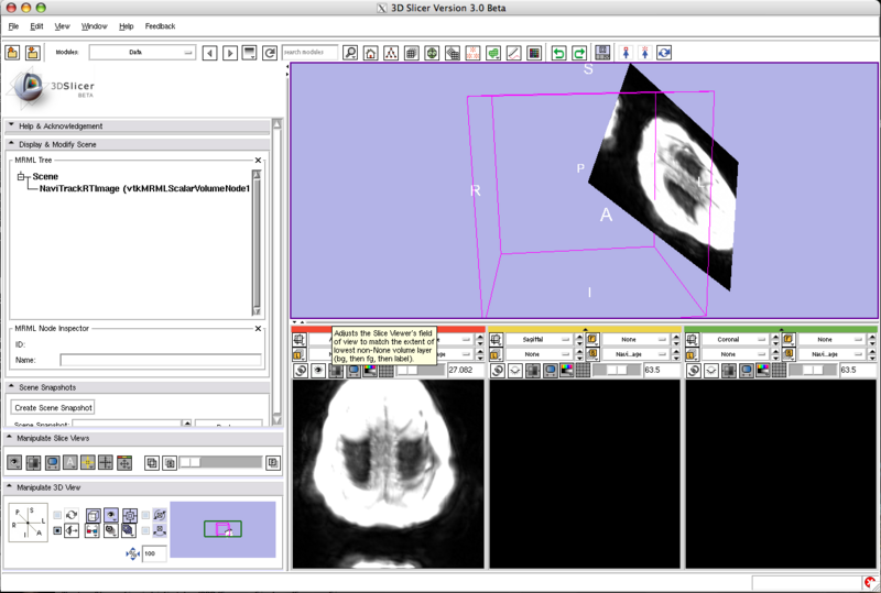 File:Slicer OpenIGTLINK.png