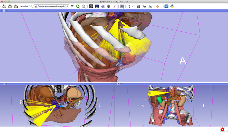 File:PercutaneousPathDesignerView5.png