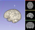 2012-09-07-FetalBrain.png