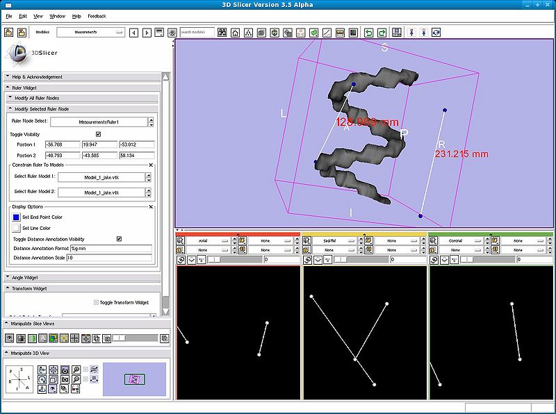 File:Slicer3.5MeasurementsRulersModel.jpeg