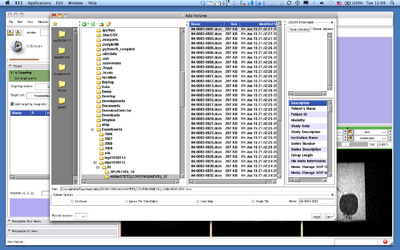 Slicer3 ProstateNav LoadTargetVolumeDialog.png