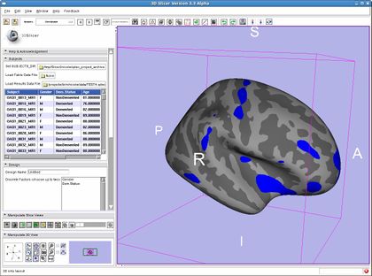 Modules:QDECModule-Documentation-3.6 - Slicer Wiki