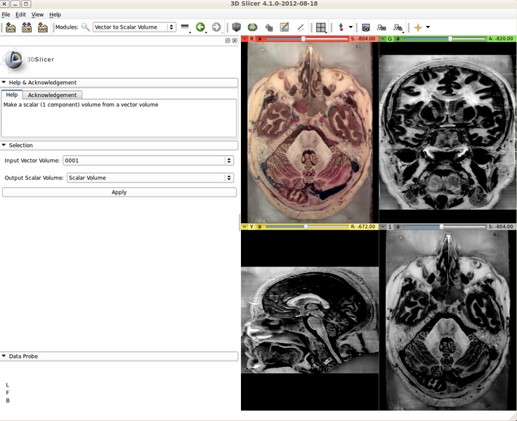 File:VectorToScalarVolume-screenshot-4.2.png