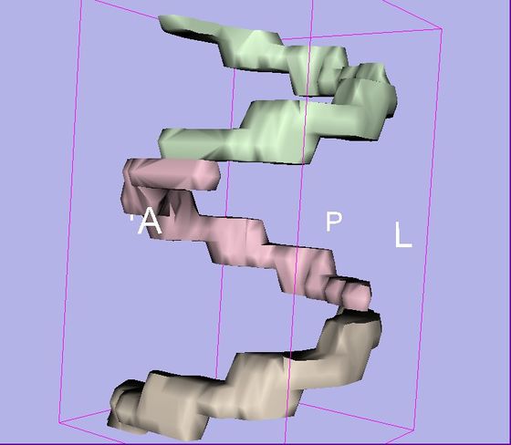 Modules:ModelMaker-Documentation-3.6 - Slicer Wiki