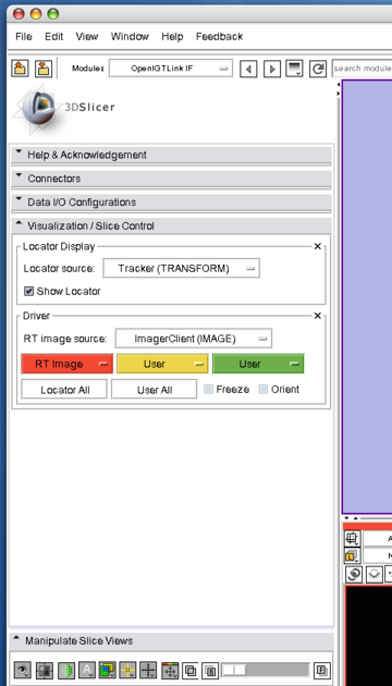 Slicer3 OpenIGTLinkIF ImagePlaneSetting2.png