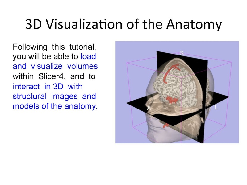 File:3DDataLoadingandVisualization SoniaPujol slicer4.4.pdf