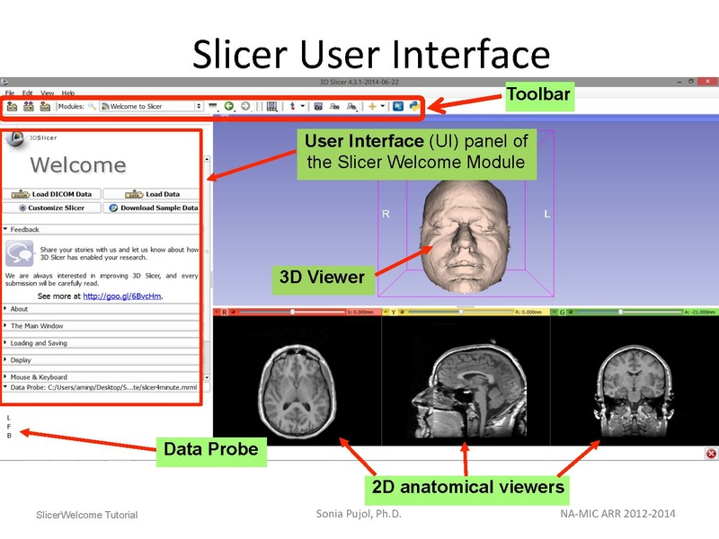 File:3DDataLoadingandVisualization SoniaPujol slicer4.4.pdf