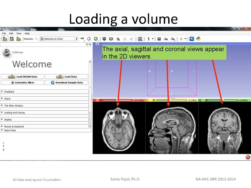 File:3DDataLoadingandVisualization SoniaPujol slicer4.4.pdf