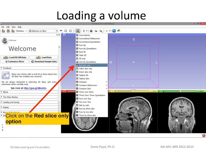 File:3DDataLoadingandVisualization SoniaPujol slicer4.4.pdf