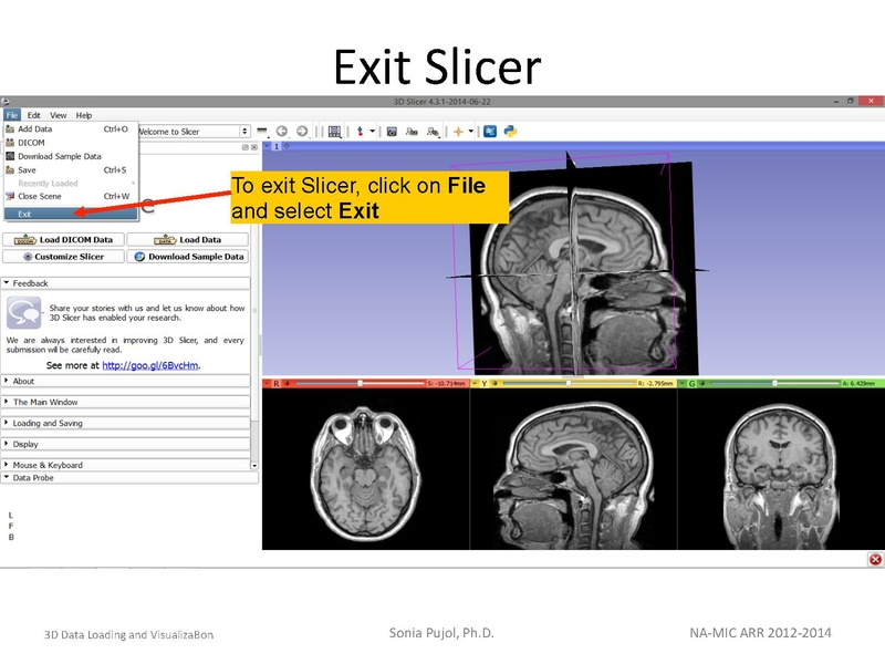 File:3DDataLoadingandVisualization SoniaPujol slicer4.4.pdf