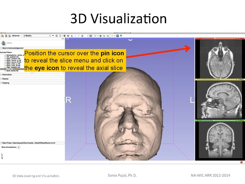 File:3DDataLoadingandVisualization SoniaPujol slicer4.4.pdf