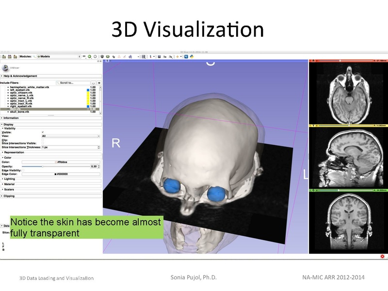 File:3DDataLoadingandVisualization SoniaPujol slicer4.4.pdf