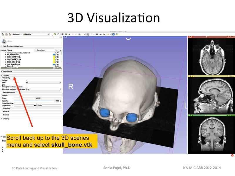 File:3DDataLoadingandVisualization SoniaPujol slicer4.4.pdf