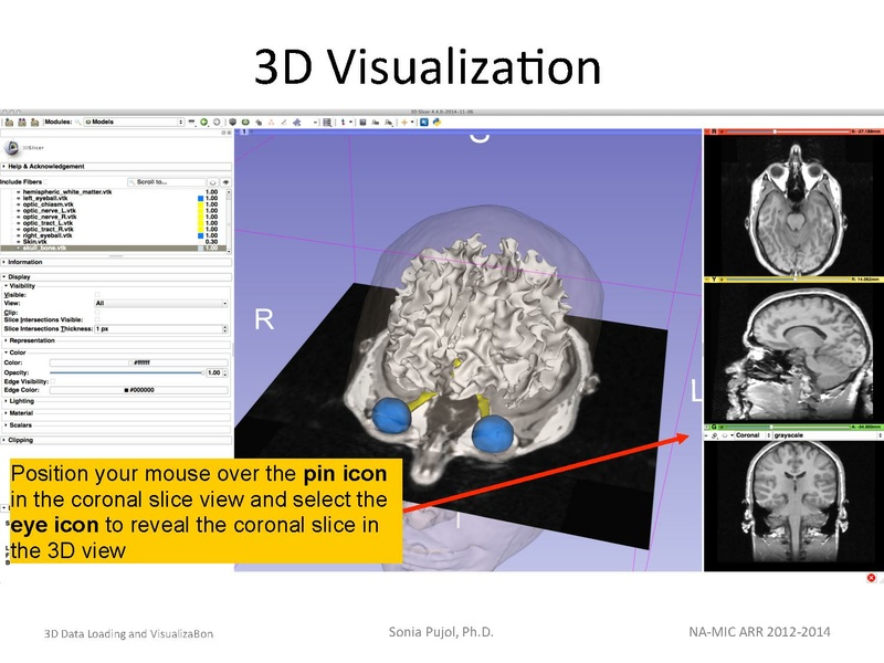 File:3DDataLoadingandVisualization SoniaPujol slicer4.4.pdf