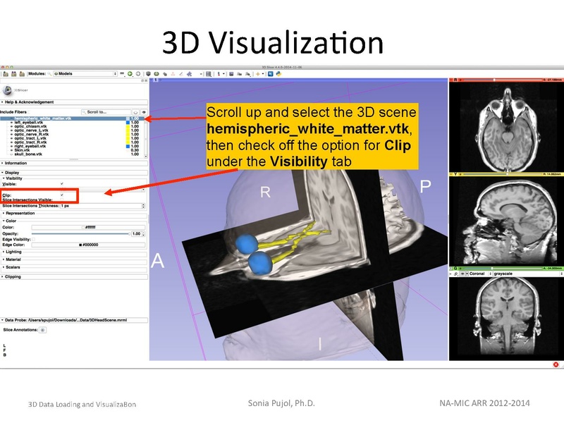 File:3DDataLoadingandVisualization SoniaPujol slicer4.4.pdf