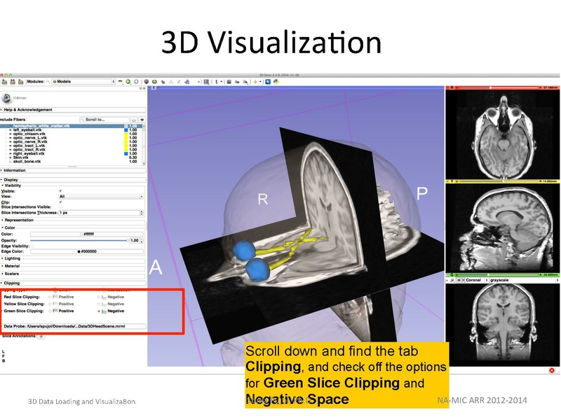 File:3DDataLoadingandVisualization SoniaPujol slicer4.4.pdf