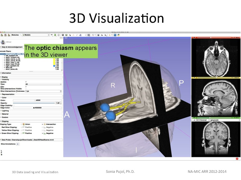 File:3DDataLoadingandVisualization SoniaPujol slicer4.4.pdf