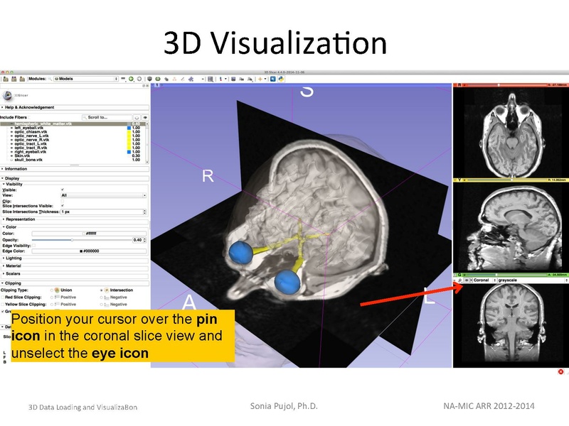 File:3DDataLoadingandVisualization SoniaPujol slicer4.4.pdf
