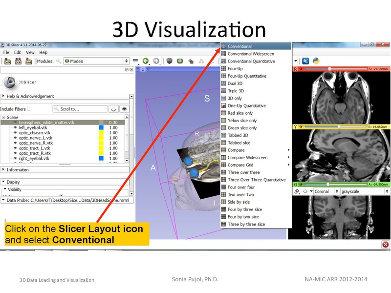 File:3DDataLoadingandVisualization SoniaPujol slicer4.4.pdf