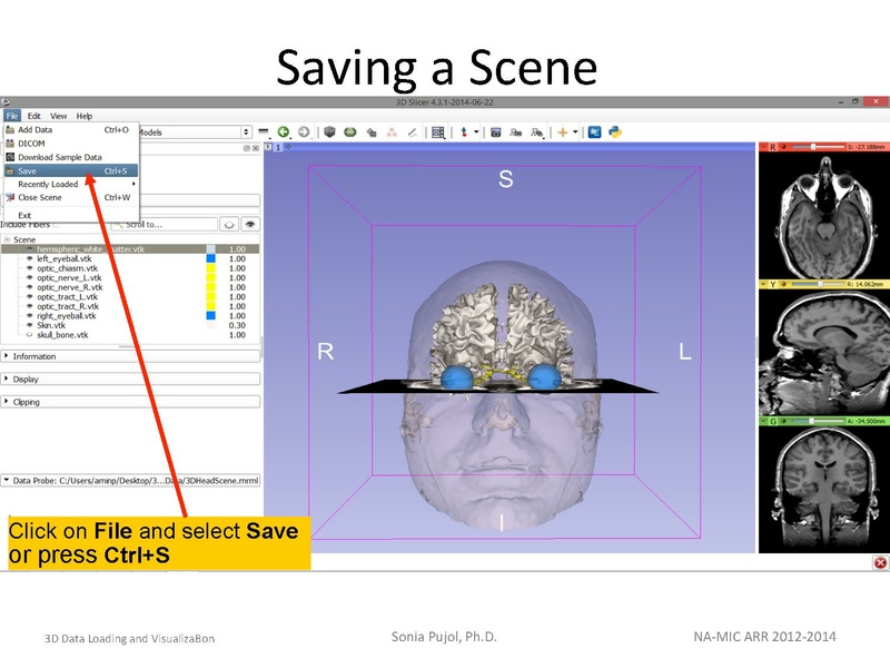 File:3DDataLoadingandVisualization SoniaPujol slicer4.4.pdf