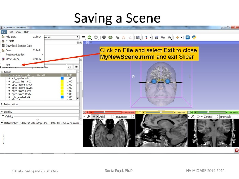 File:3DDataLoadingandVisualization SoniaPujol slicer4.4.pdf