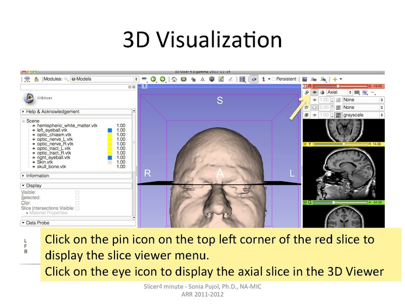 File:Slicer4minute-tutorial SoniaPujol.pdf