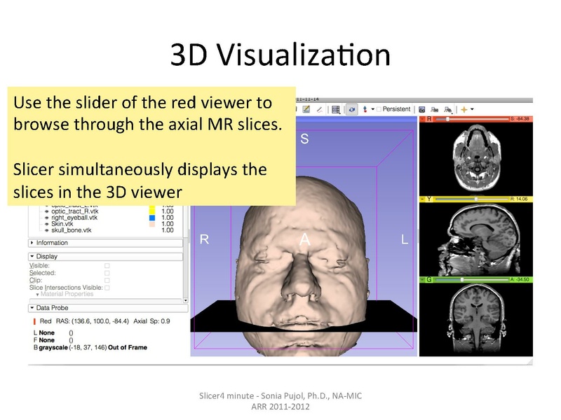 File:Slicer4minute-tutorial SoniaPujol.pdf