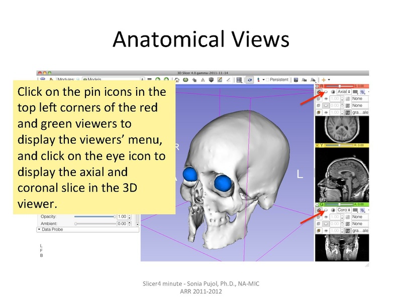 File:Slicer4minute-tutorial SoniaPujol.pdf