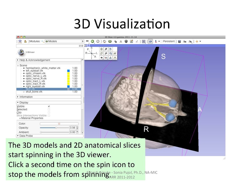 File:Slicer4minute-tutorial SoniaPujol.pdf