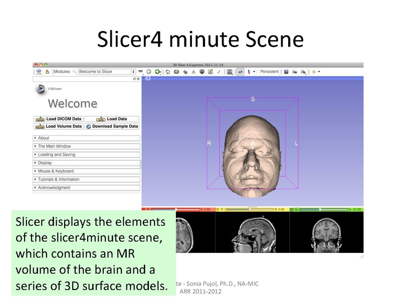 File:Slicer4minute-tutorial SoniaPujol.pdf