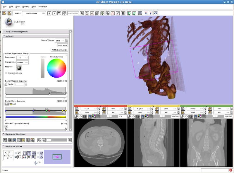 File:VolumeRenderingBoneDetection.png