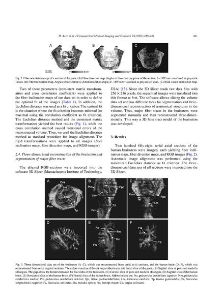 File:Axer-ComputMedImagingGraph2002.pdf