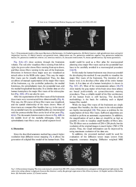 File:Axer-ComputMedImagingGraph2002.pdf